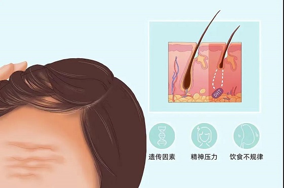 【脫發(fā)不可小覷 域發(fā)微針來啦】黃驊市人民醫(yī)院皮膚科開展域發(fā)微針生發(fā)技術(shù)